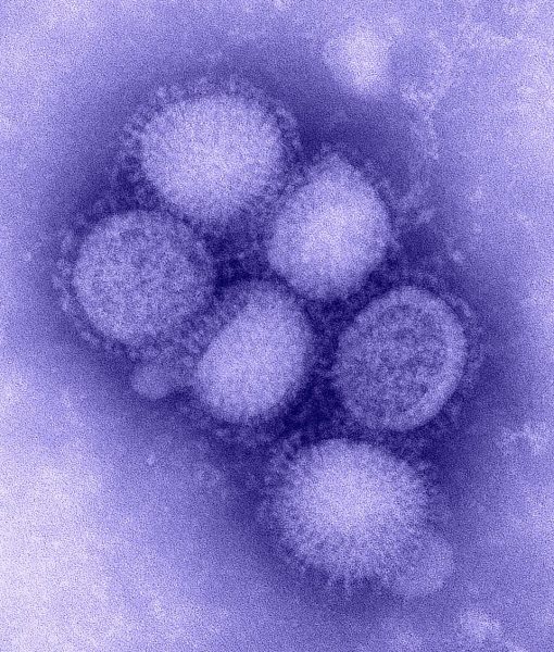 H1N1_influenza_virus