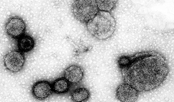 電子顕微鏡で見たインフルエンザウイルス