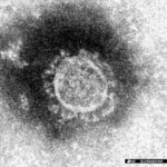 新型コロナウイルスの電子顕微鏡写真（国立感染症研究所提供）