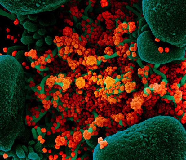 SARS-CoV-2ウイルスの電子顕微鏡写真