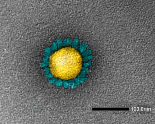 新型コロナウイルス変異株（デルタ株）の透過型電子顕微鏡像